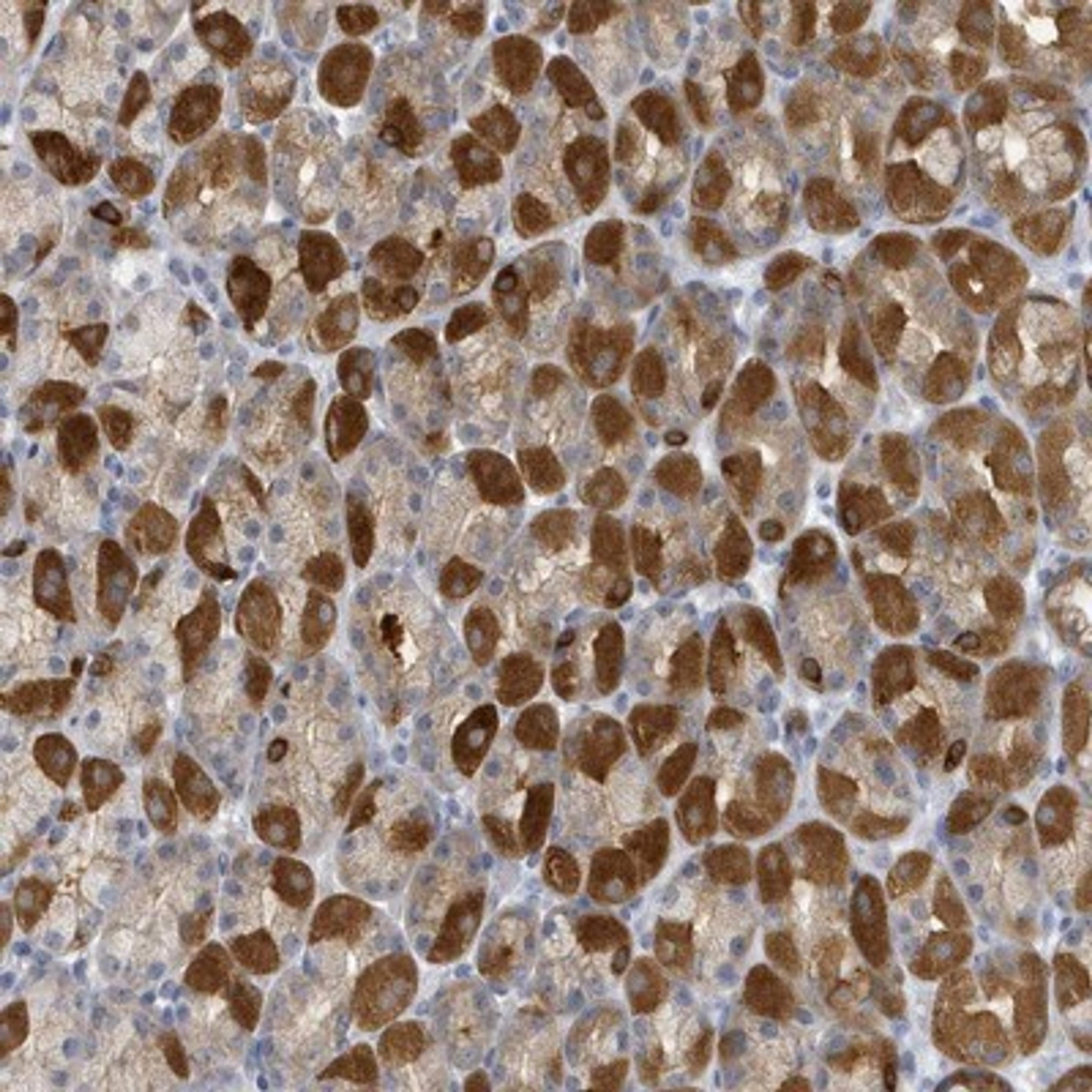 Immunohistochemistry-Paraffin: VTA1 Antibody [NBP1-86745] - Staining of human stomach shows strong cytoplasmic positivity in parietal cells.