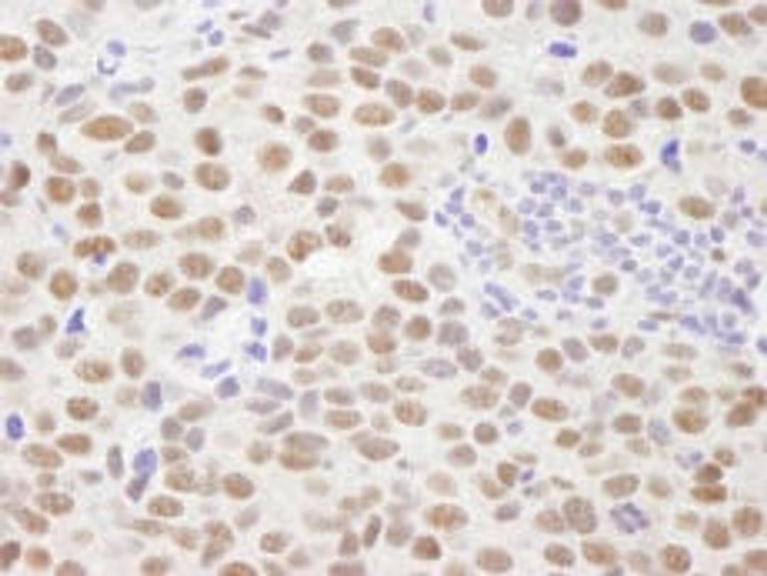 Detection of human PPM1G by immunohistochemistry.