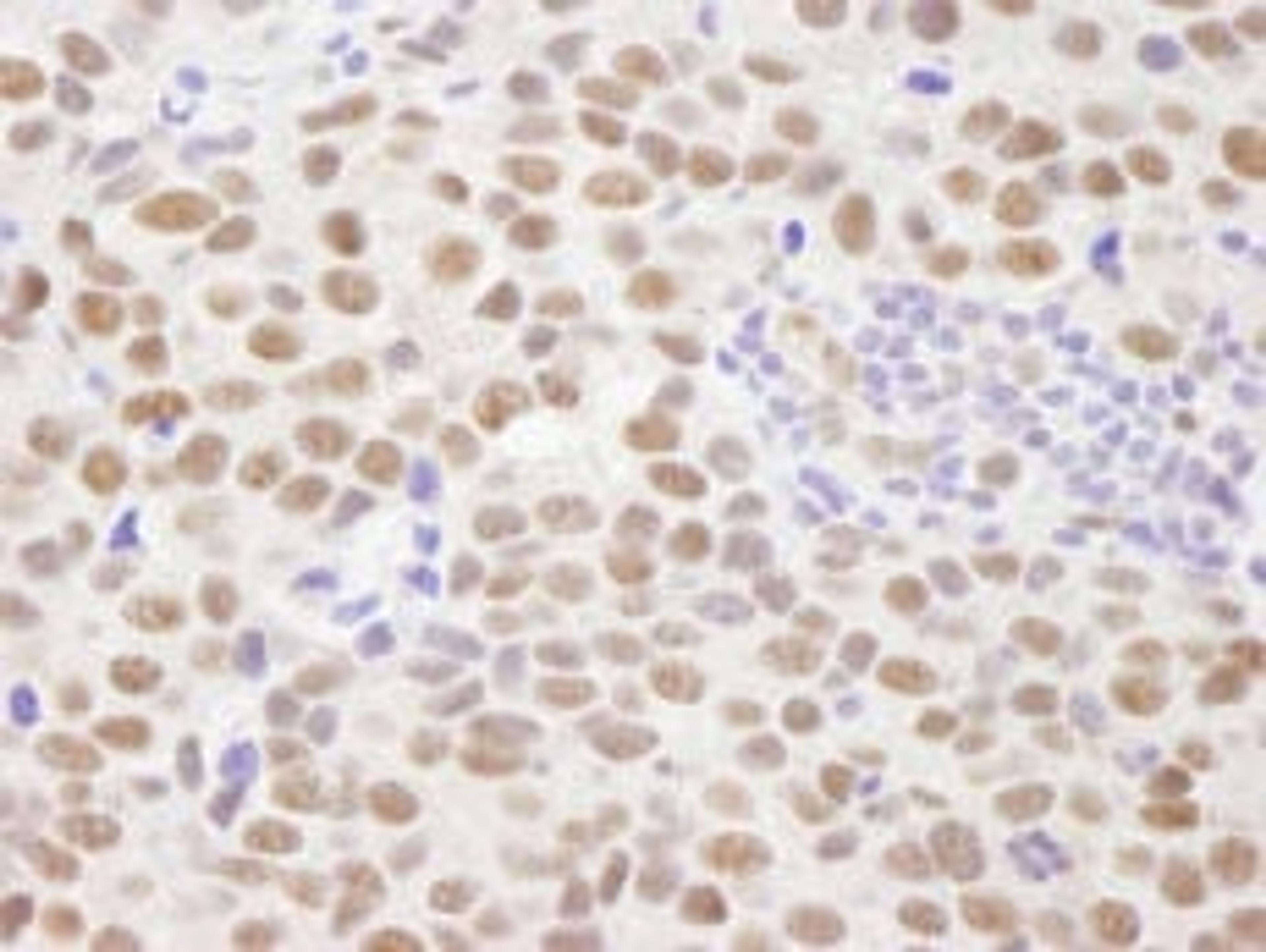 Detection of human PPM1G by immunohistochemistry.