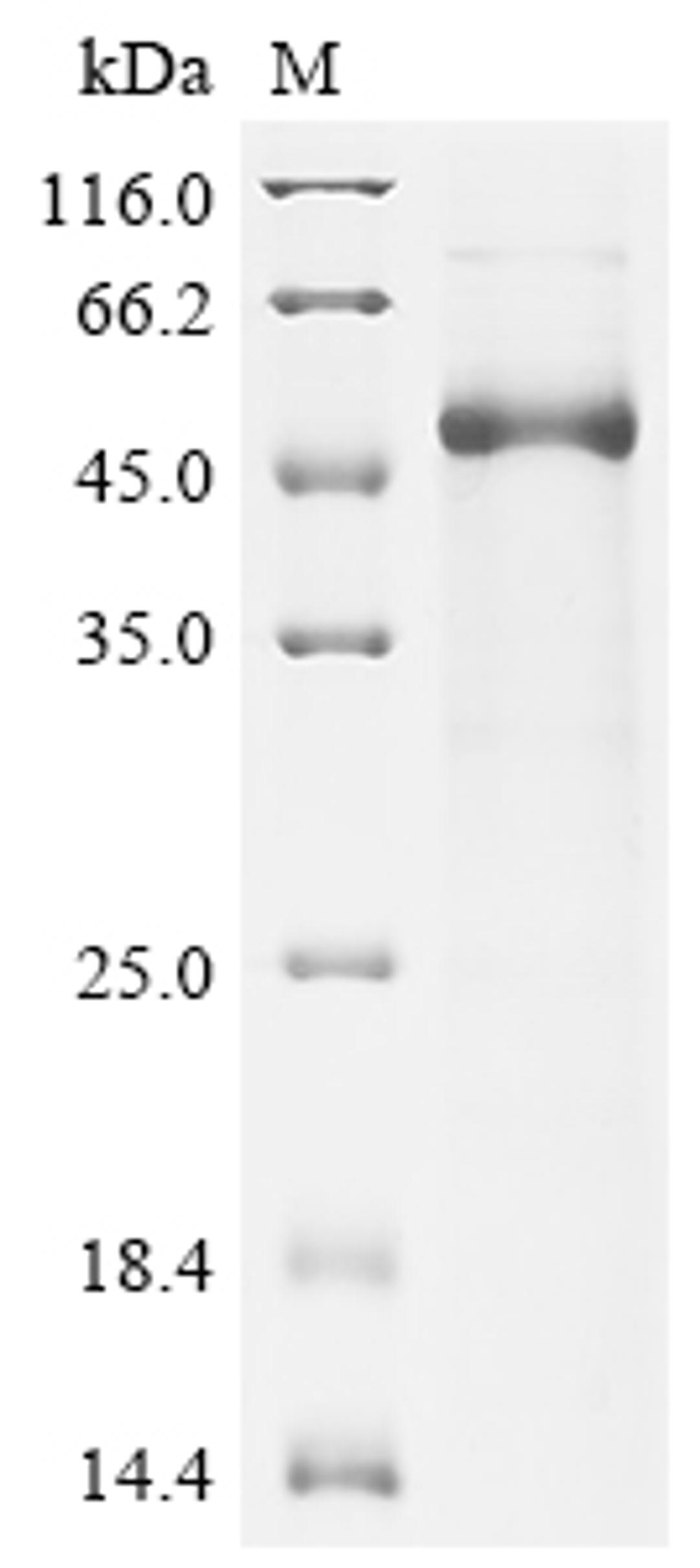 (Tris-Glycine gel) Discontinuous SDS-PAGE (reduced) with 5% enrichment gel and 15% separation gel.
