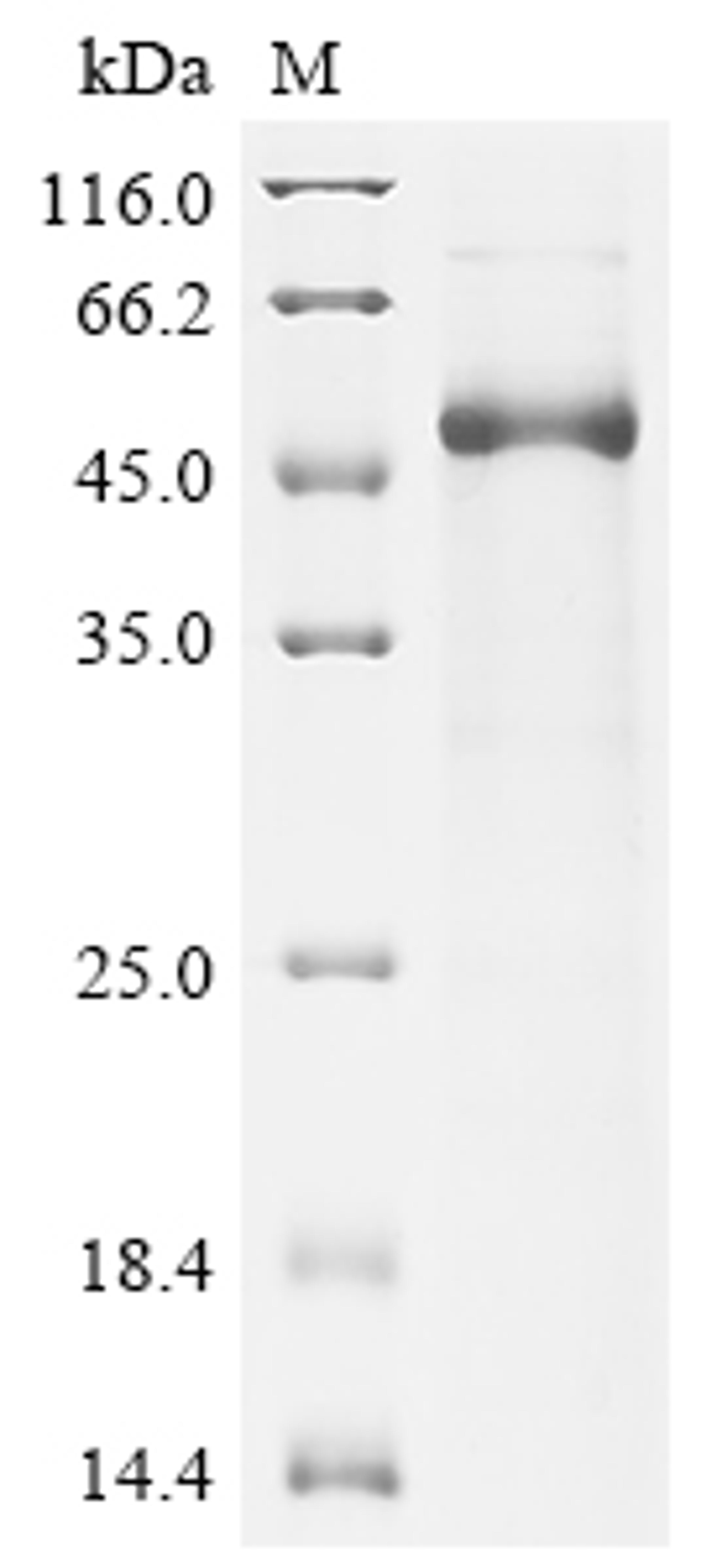 (Tris-Glycine gel) Discontinuous SDS-PAGE (reduced) with 5% enrichment gel and 15% separation gel.