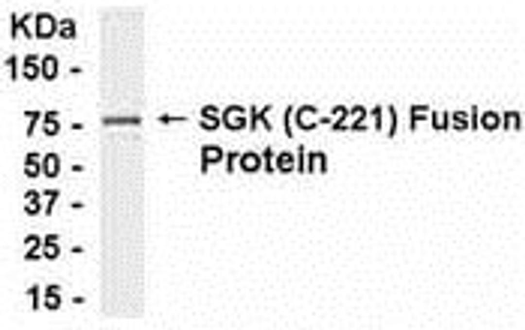 E coli-derived fusion protein as test antigen. Affinity-purified IgY dilution: 1:2000, Goat anti-IgY-HRP dilution: 1:1000. Colorimetric method for signal development.