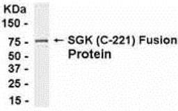 E coli-derived fusion protein as test antigen. Affinity-purified IgY dilution: 1:2000, Goat anti-IgY-HRP dilution: 1:1000. Colorimetric method for signal development.