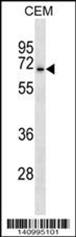 Western blot analysis in CEM cell line lysates (35ug/lane).