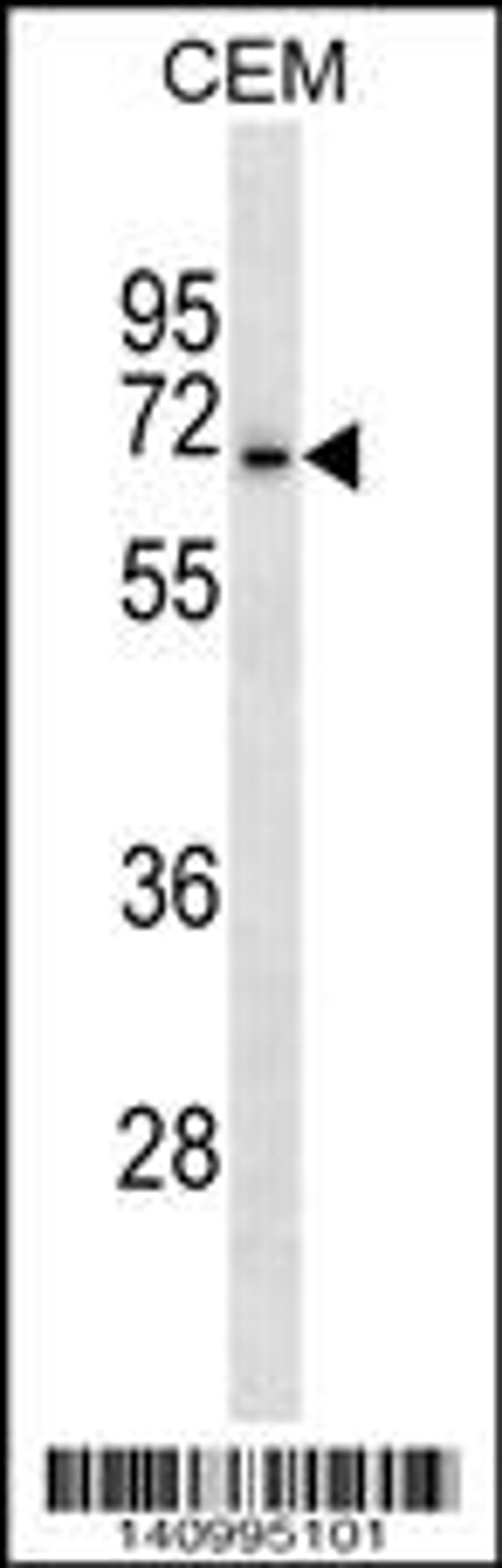 Western blot analysis in CEM cell line lysates (35ug/lane).