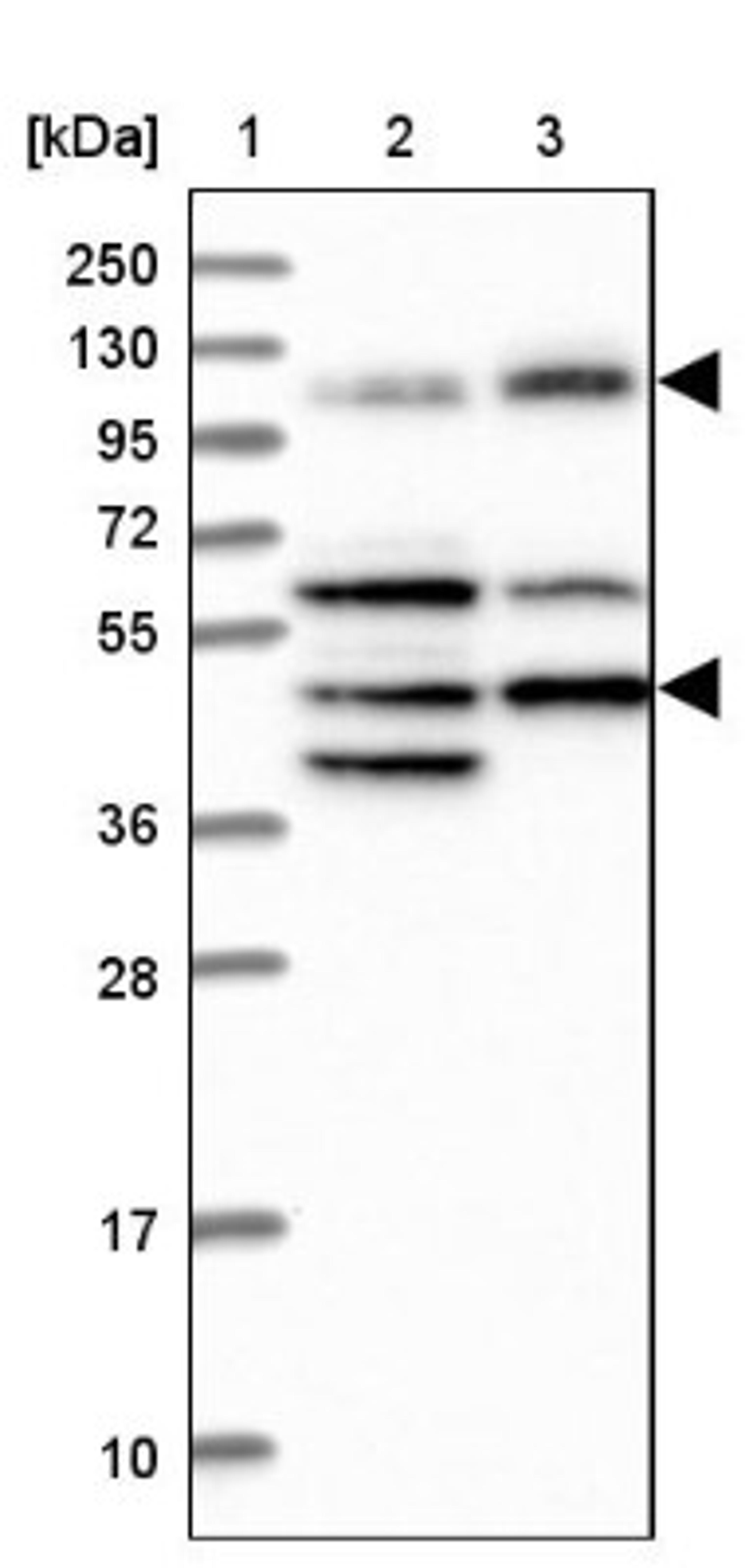 Western Blot: IFT122 Antibody [NBP1-87014] - Lane 1: Marker [kDa] 250, 130, 95, 72, 55, 36, 28, 17, 10<br/>Lane 2: Human cell line RT-4<br/>Lane 3: Human cell line U-251MG sp