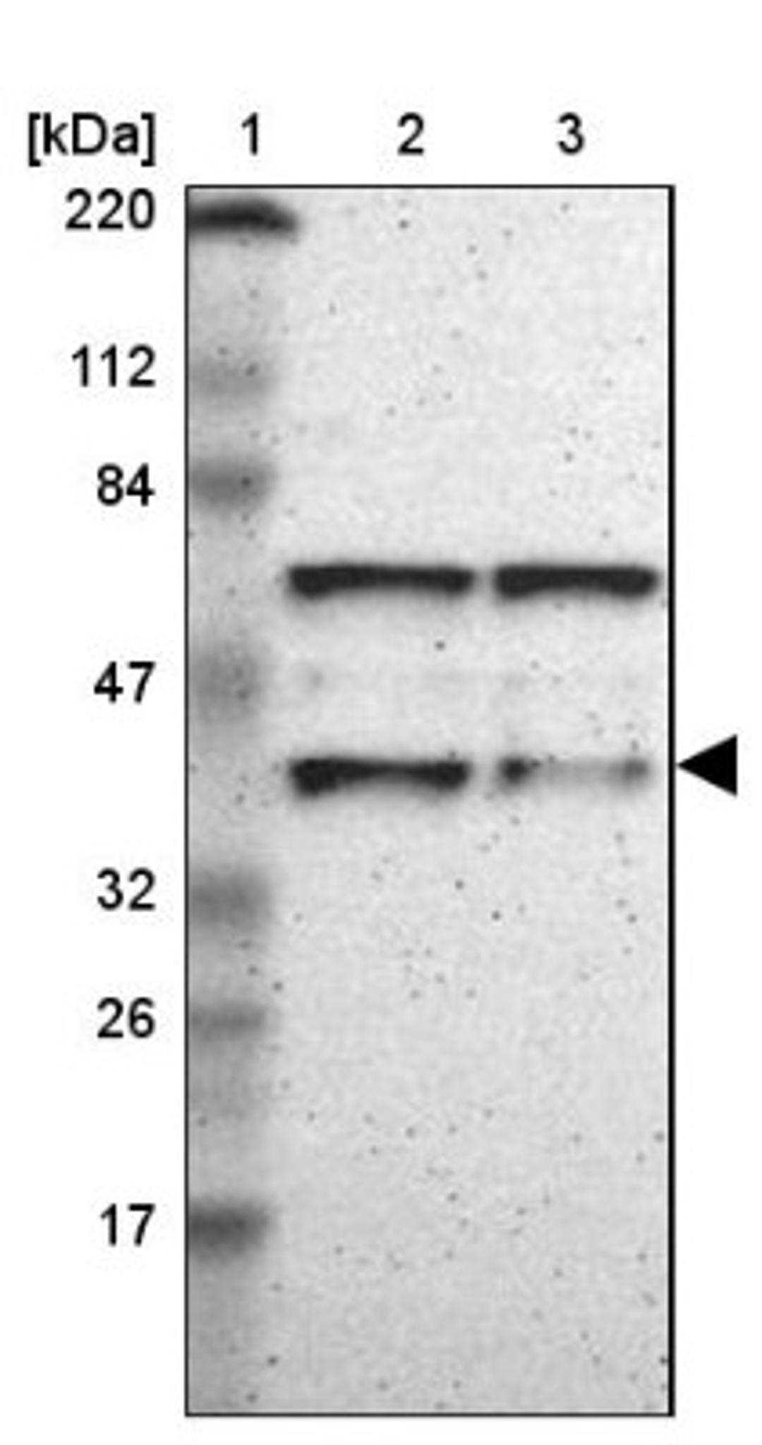 Western Blot: PBX1 Antibody [NBP1-85803] - Lane 1: Marker [kDa] 220, 112, 84, 47, 32, 26, 17<br/>Lane 2: Human cell line RT-4<br/>Lane 3: Human cell line U-251MG sp