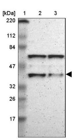 Western Blot: PBX1 Antibody [NBP1-85803] - Lane 1: Marker [kDa] 220, 112, 84, 47, 32, 26, 17<br/>Lane 2: Human cell line RT-4<br/>Lane 3: Human cell line U-251MG sp