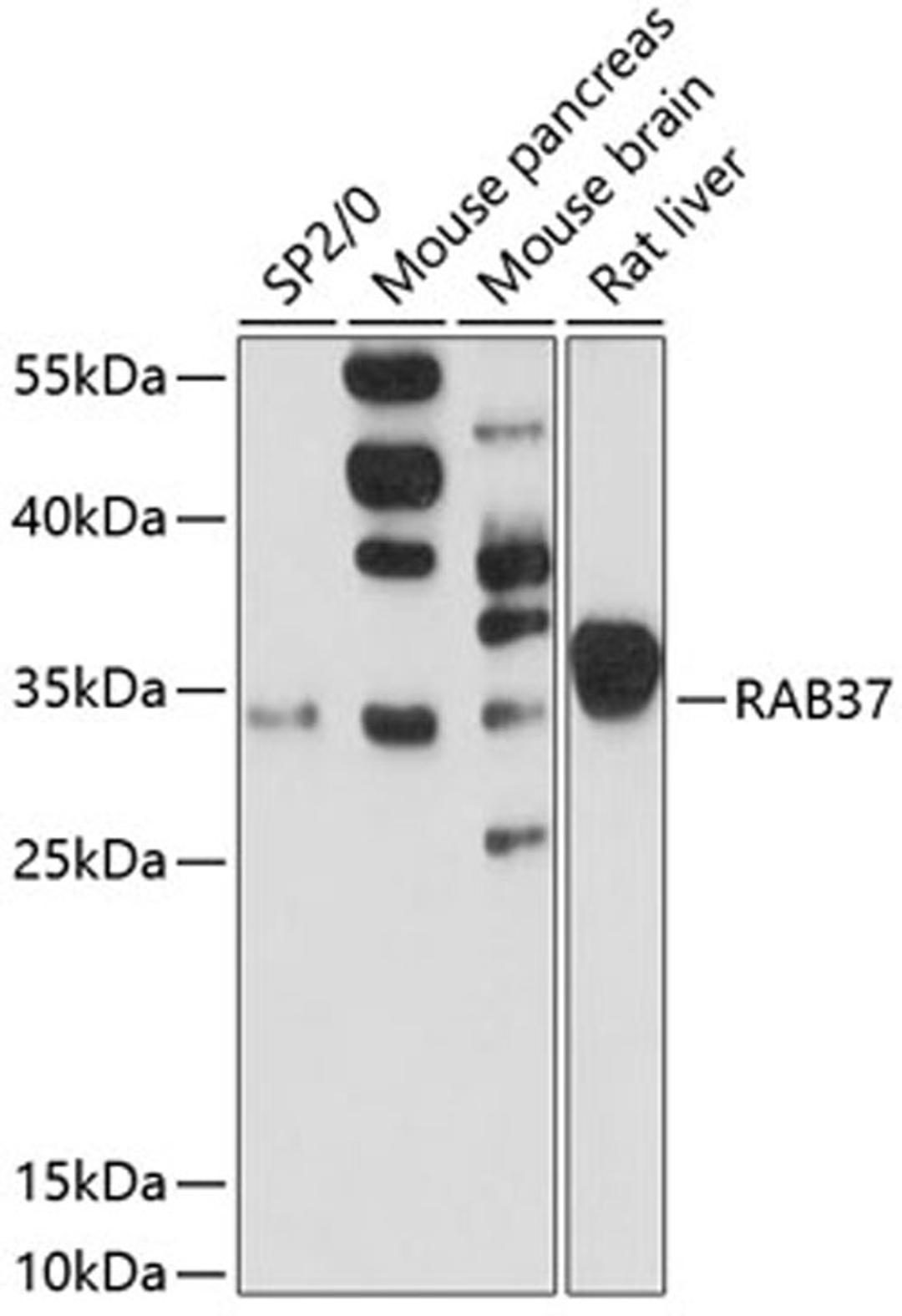 Western blot - RAB37 antibody (A13704)