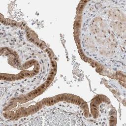 Immunohistochemistry: B7-H6 Antibody [NBP1-91144] - Staining of human gall bladder shows strong nuclear and cytoplasmic positivity in glandular cells.