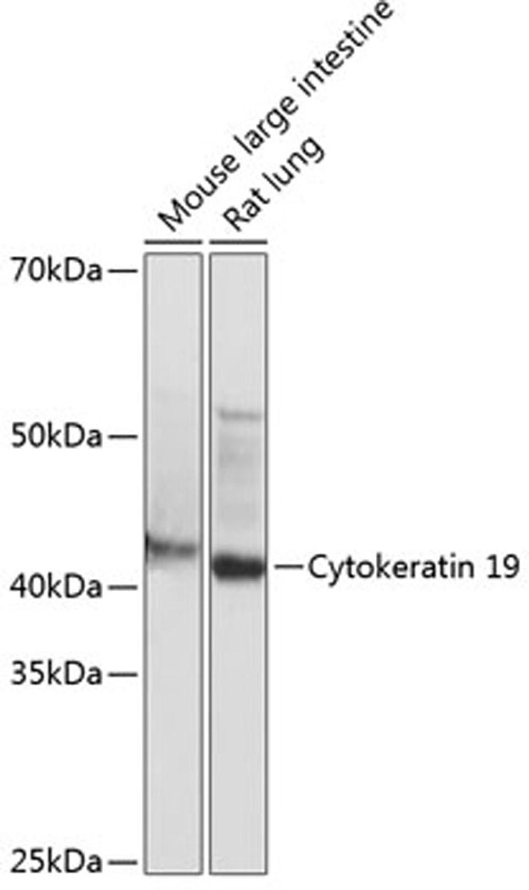 Western blot - Cytokeratin 19 antibody (A19040)