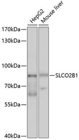 Western blot - SLCO2B1 antibody (A10073)