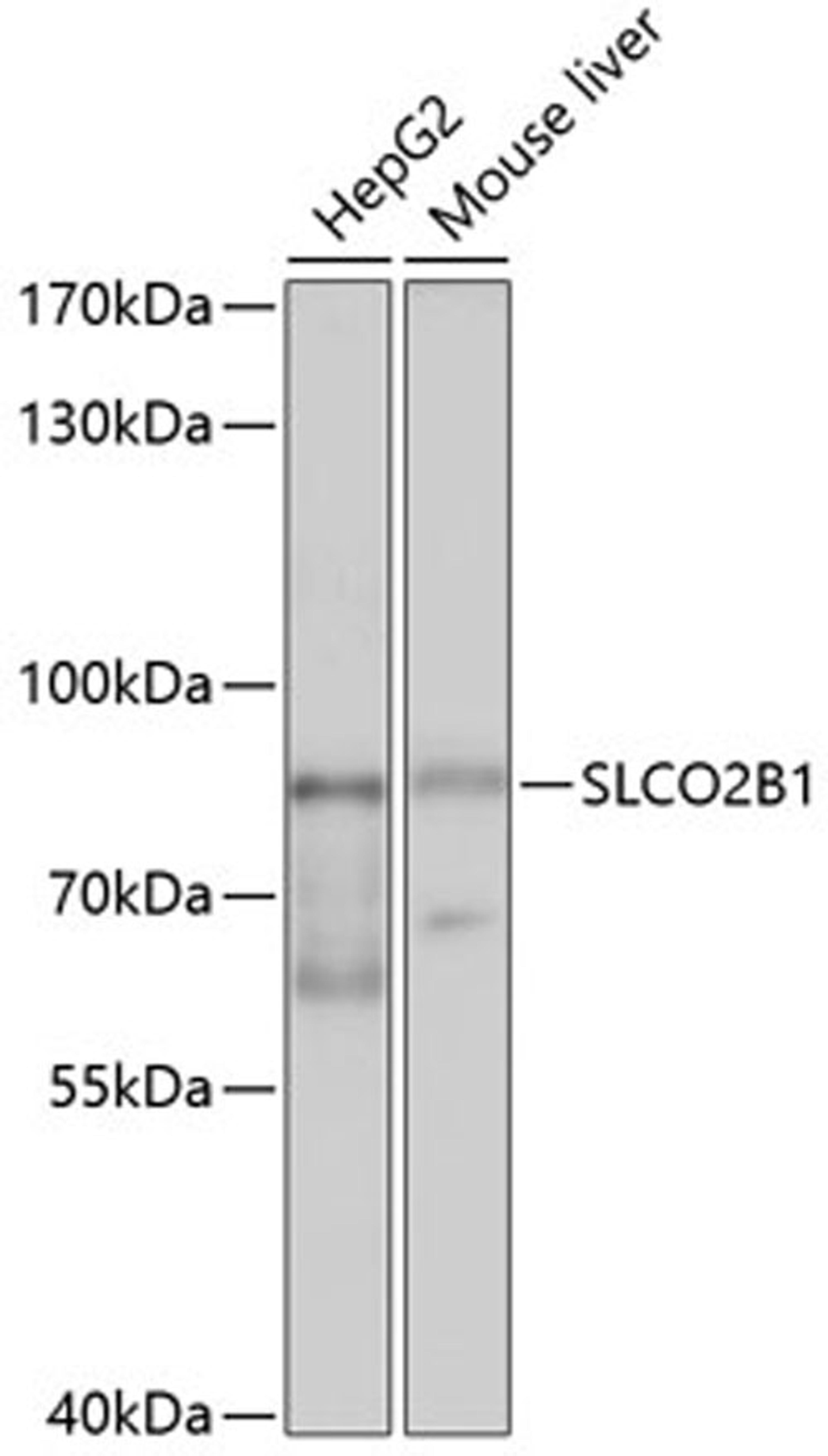 Western blot - SLCO2B1 antibody (A10073)