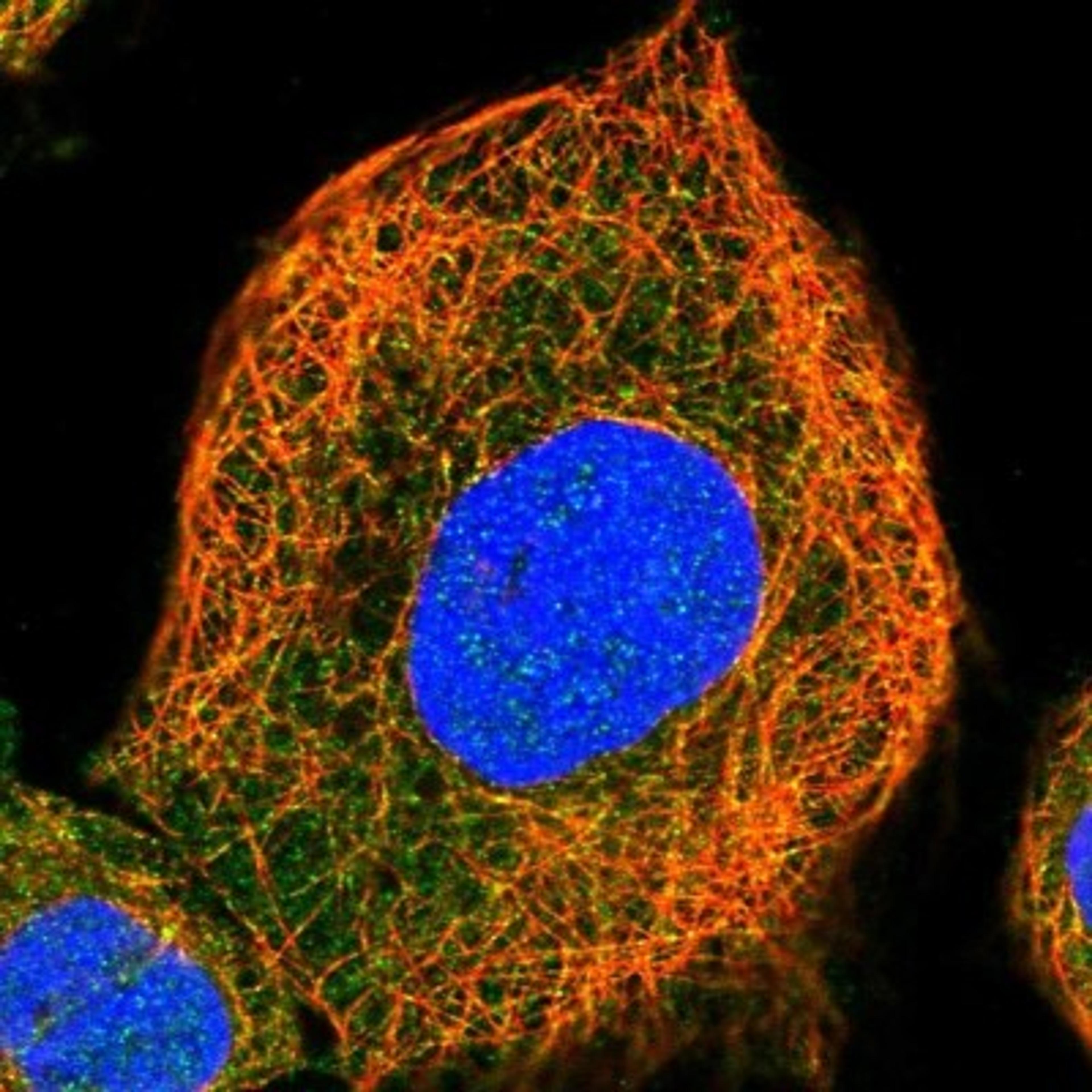 Immunocytochemistry/Immunofluorescence: AIDA Antibody [NBP1-88323] - Staining of human cell line A-431 shows positivity in cytoplasm & cytoskeleton (microtubules).