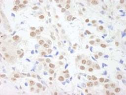 Detection of human SAFB1 by immunohistochemistry.