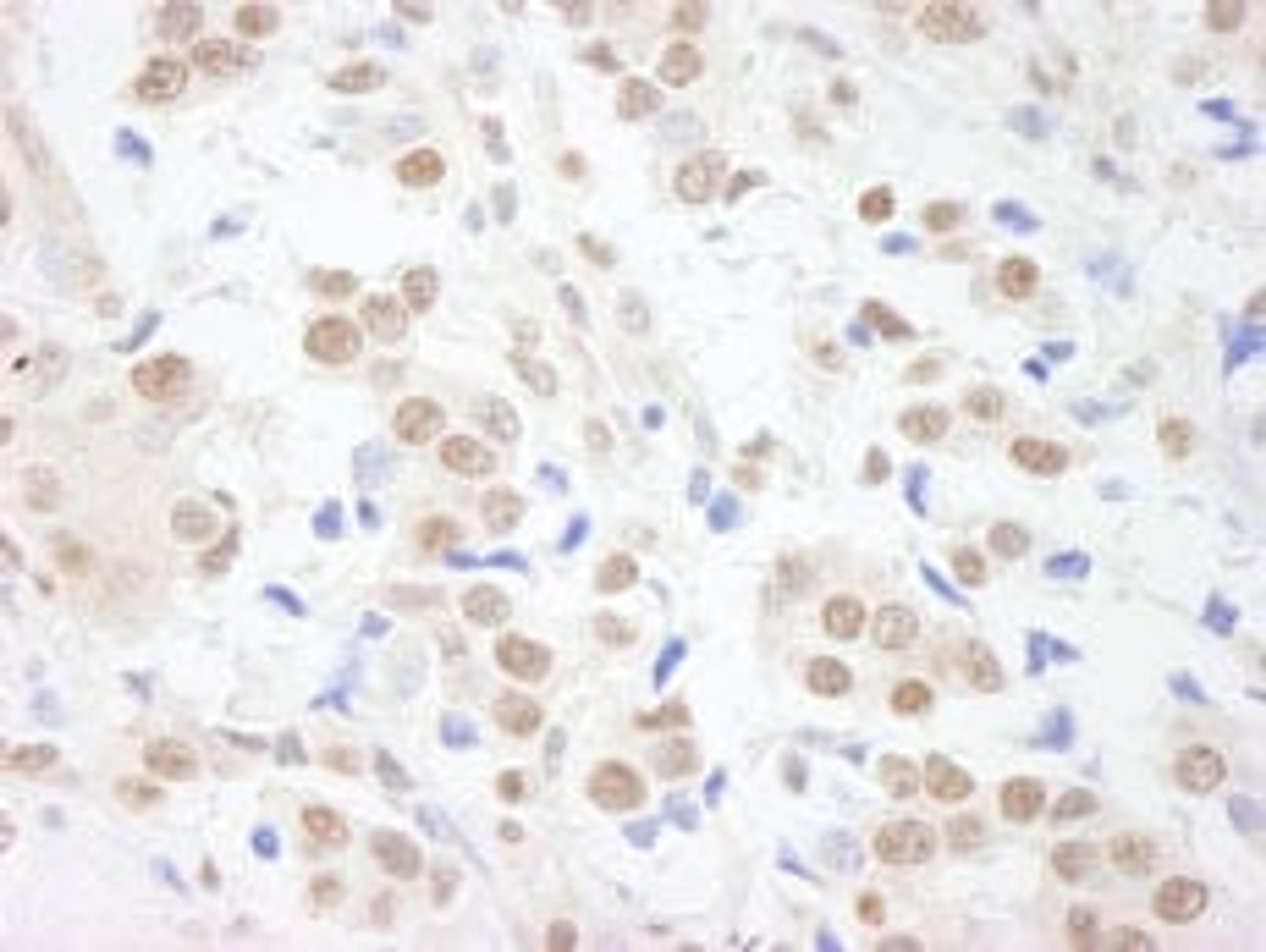 Detection of human SAFB1 by immunohistochemistry.