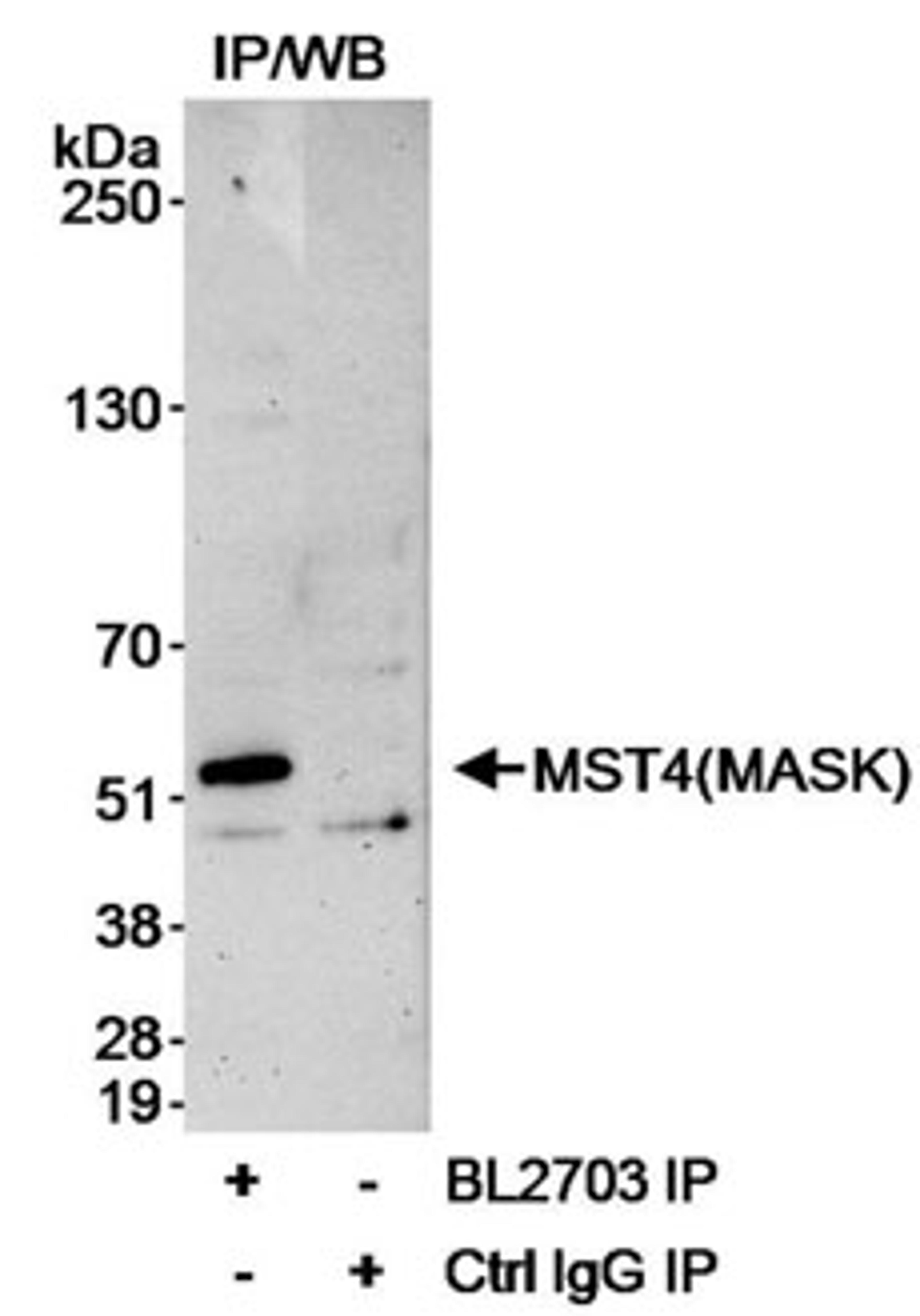 Detection of human MST4(MASK) by western blot after immunoprecipitation.