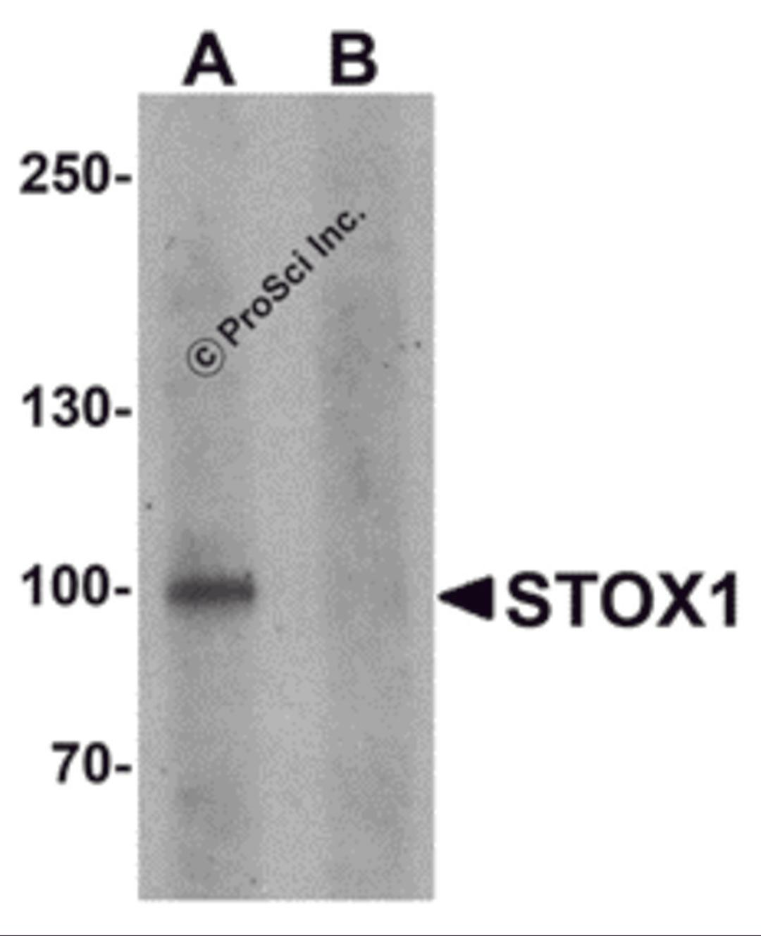 Western blot analysis of STOX1 in human liver tissue lysate with STOX1 antibody at 1 μg/ml in (A) the absence and (B) the presence of blocking peptide.