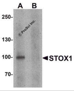 Western blot analysis of STOX1 in human liver tissue lysate with STOX1 antibody at 1 μg/ml in (A) the absence and (B) the presence of blocking peptide.