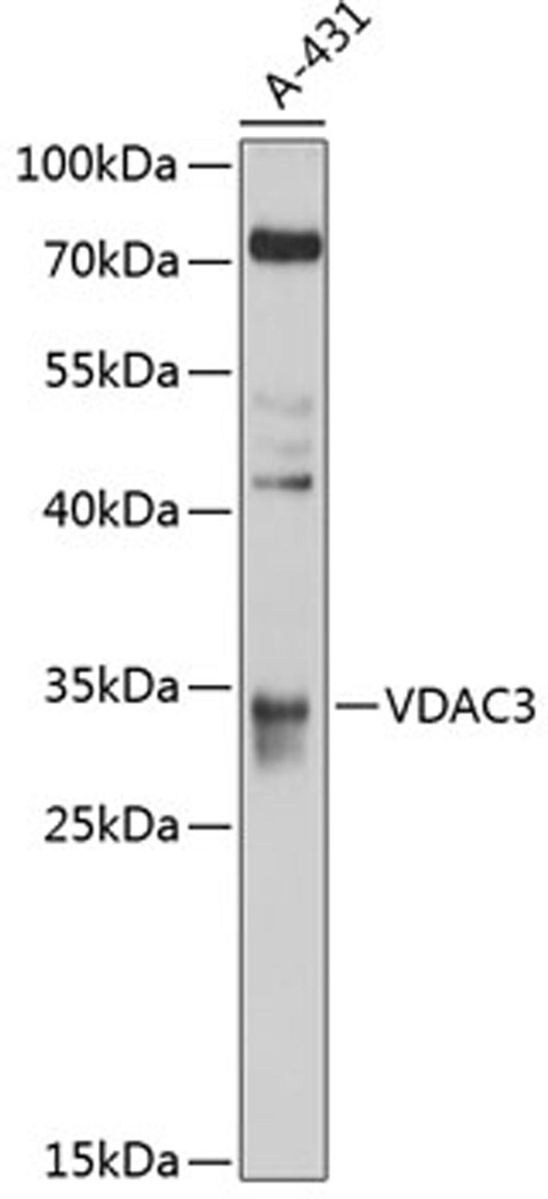 Western blot - VDAC3 antibody (A10544)