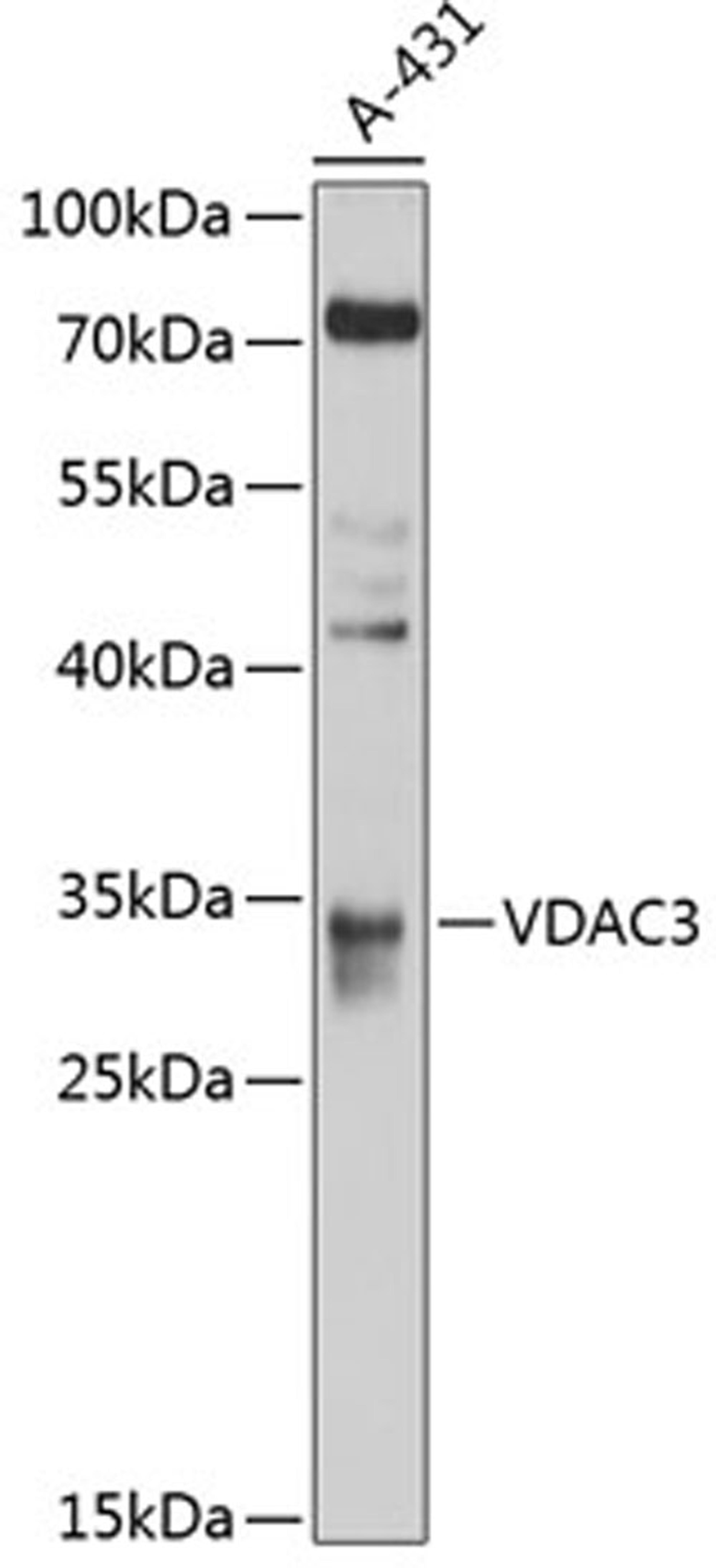 Western blot - VDAC3 antibody (A10544)