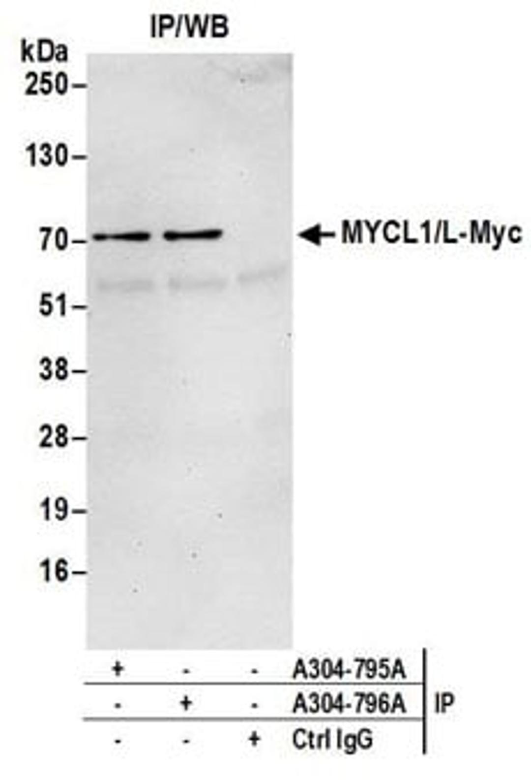 Detection of human MYCL1/L-Myc by western blot of immunoprecipitates.