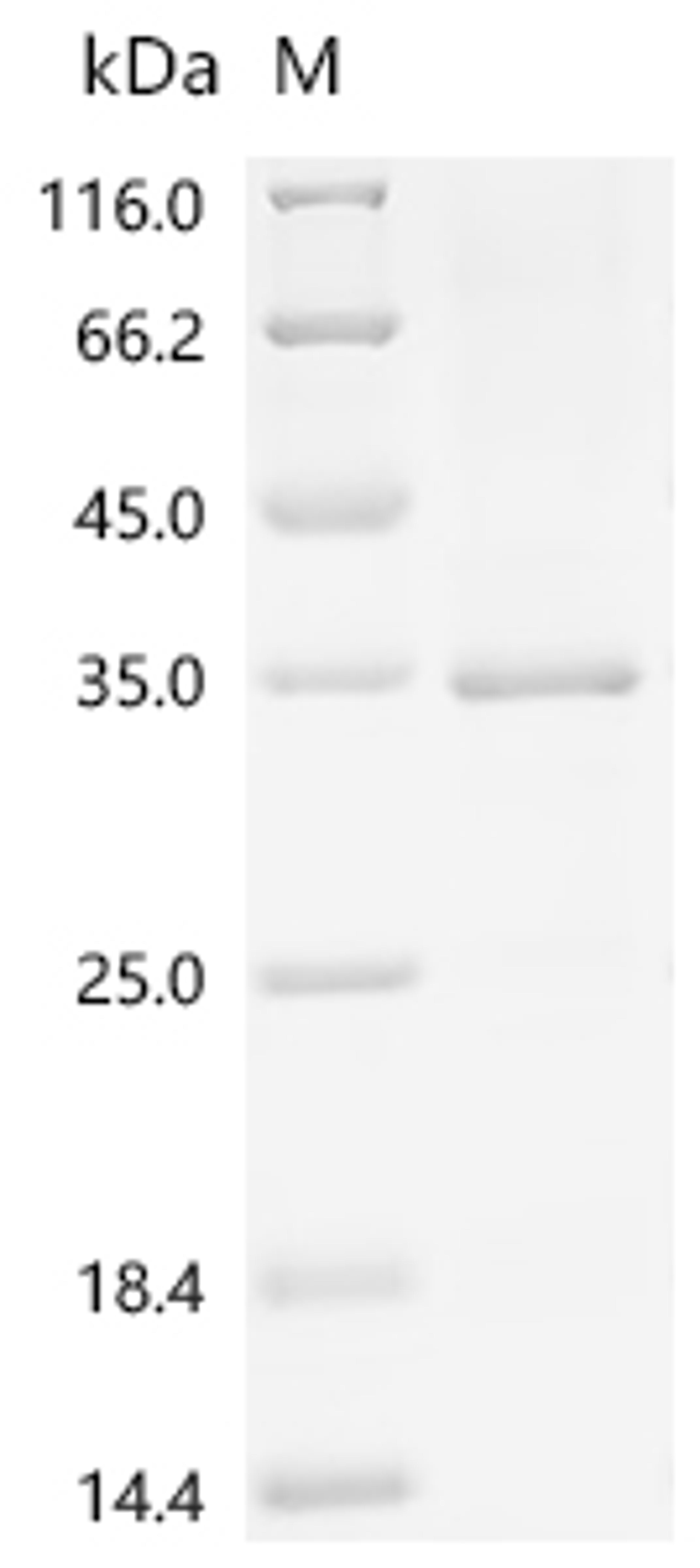 (Tris-Glycine gel) Discontinuous SDS-PAGE (reduced) with 5% enrichment gel and 15% separation gel.
