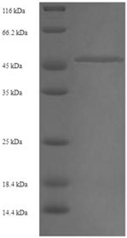 (Tris-Glycine gel) Discontinuous SDS-PAGE (reduced) with 5% enrichment gel and 15% separation gel.