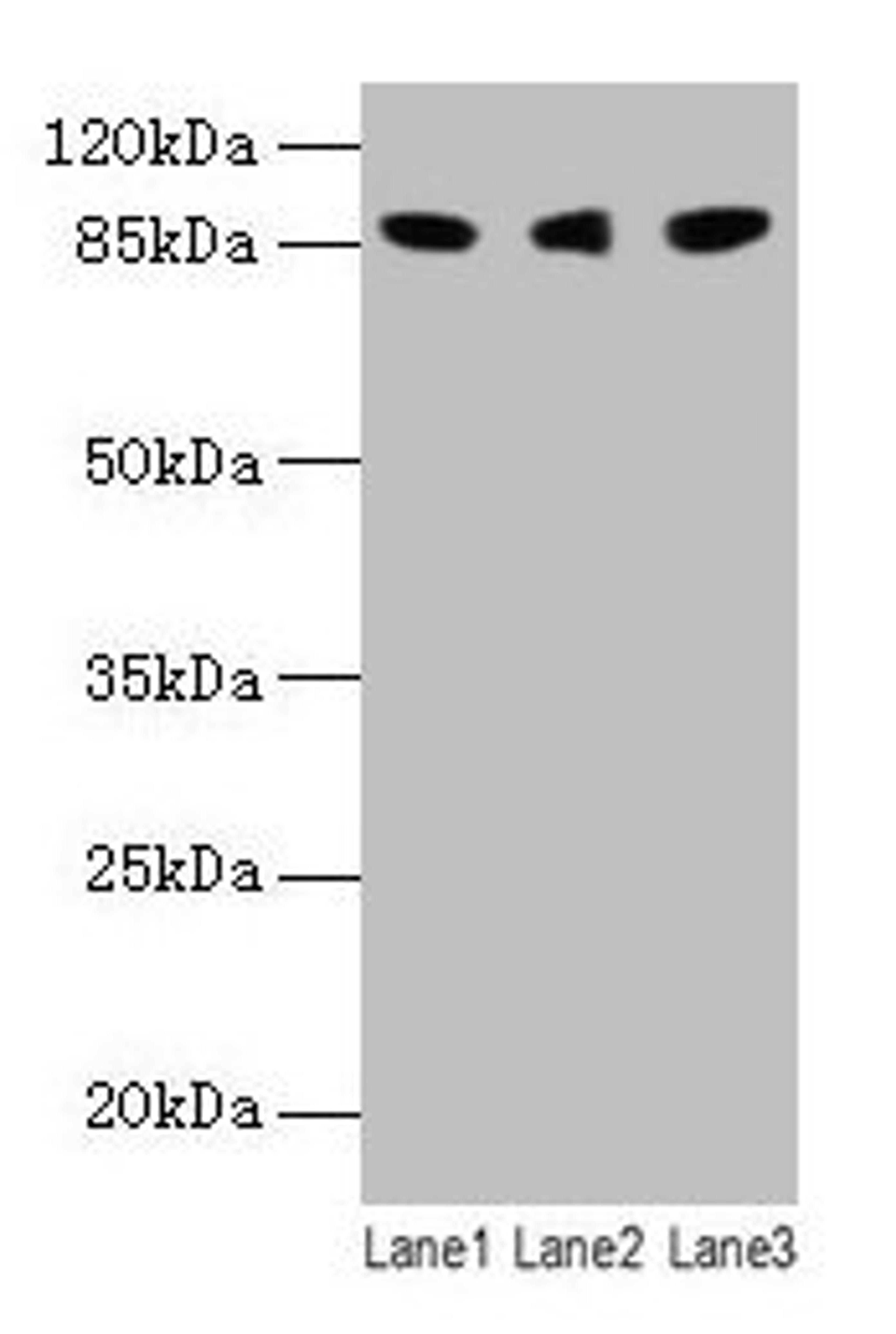 Western blot. All lanes: Loxl2 antibody at 14µg/ml. Lane 1: 293T whole cell lysate. Lane 2: A549 whole cell lysate. Lane 3: A431 whole cell lysate. Secondary. Goat polyclonal to rabbit IgG at 1/10000 dilution. Predicted band size: 88, 82 kDa. Observed band size: 88 kDa