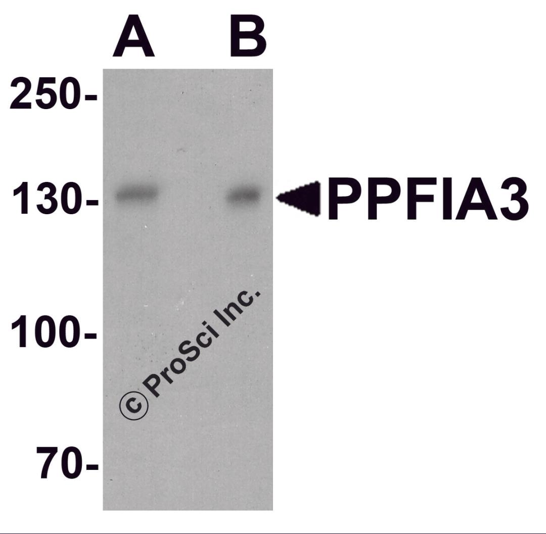 Western blot analysis of PPFIA3 in 293 cell lysate with PPFIA3 antibody at (A) 1 and (B) 2 μg/ml.