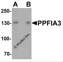 Western blot analysis of PPFIA3 in 293 cell lysate with PPFIA3 antibody at (A) 1 and (B) 2 μg/ml.