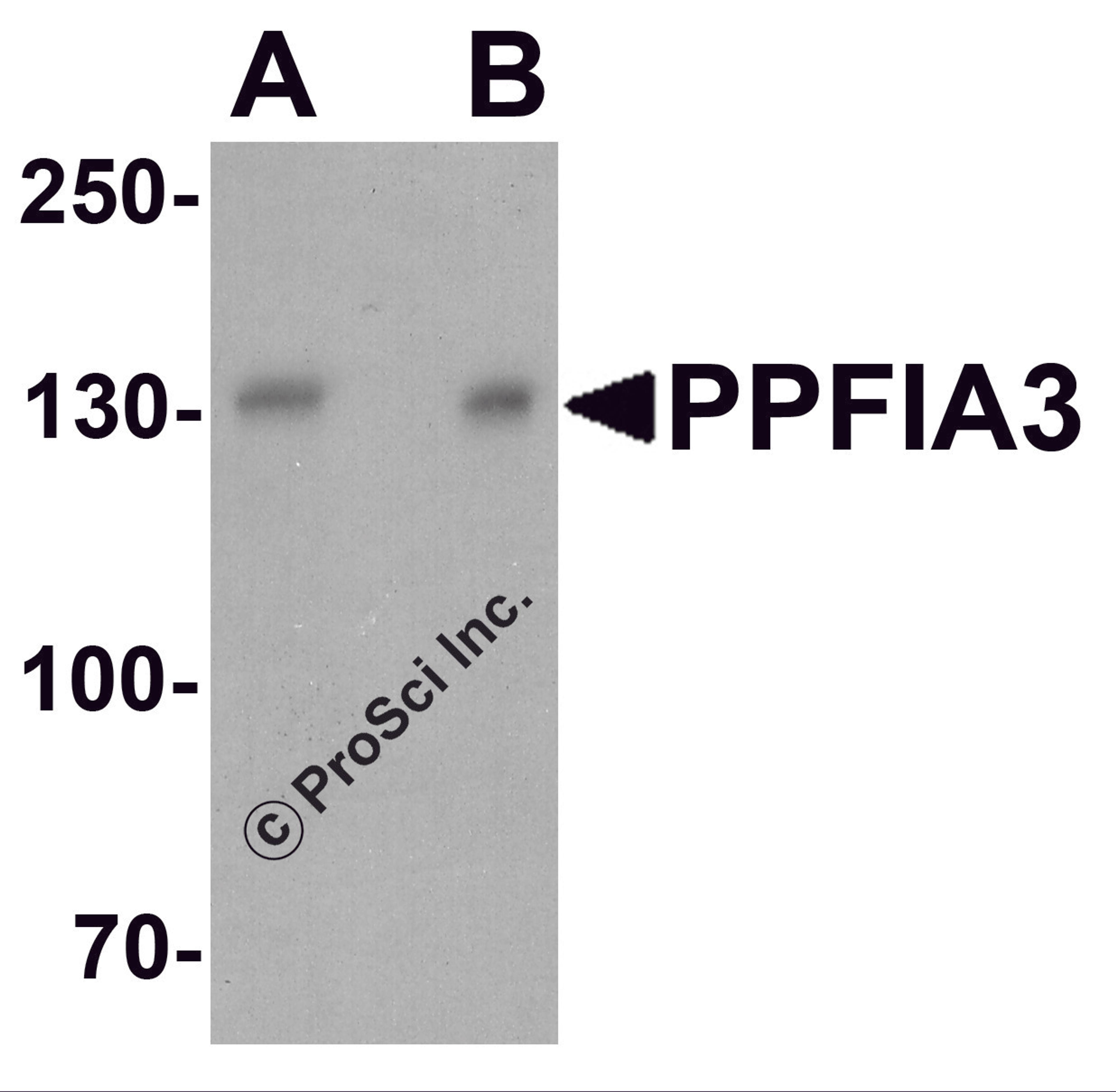 Western blot analysis of PPFIA3 in 293 cell lysate with PPFIA3 antibody at (A) 1 and (B) 2 μg/ml.