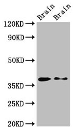 Western Blot. Positive WB detected in: Rat brain tissue, Mouse brain tissue. All lanes: PEX10 antibody at 2.7ug/ml. Secondary. Goat polyclonal to rabbit IgG at 1/50000 dilution. Predicted band size: 38, 40 kDa. Observed band size: 38 kDa.