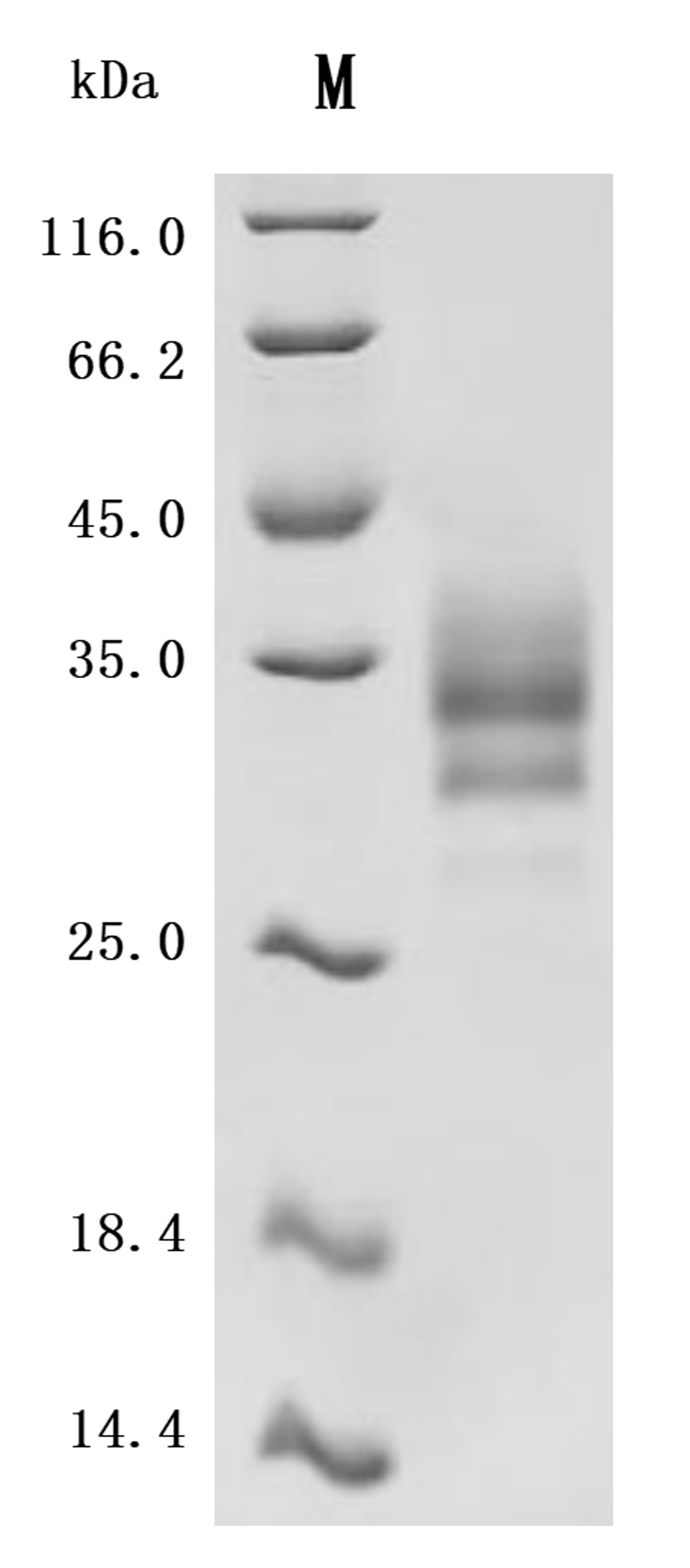 (Tris-Glycine gel) Discontinuous SDS-PAGE (reduced) with 5% enrichment gel and 15% separation gel.
