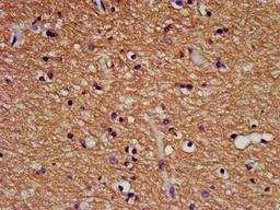 IHC image of CSB-PA11547A0Rb diluted at 1:500 and staining in paraffin-embedded human brain tissue performed on a Leica BondTM system. After dewaxing and hydration, antigen retrieval was mediated by high pressure in a citrate buffer (pH 6.0). Section was blocked with 10% normal goat serum 30min at RT. Then primary antibody (1% BSA) was incubated at 4&deg;C overnight. The primary is detected by a biotinylated secondary antibody and visualized using an HRP conjugated SP system.