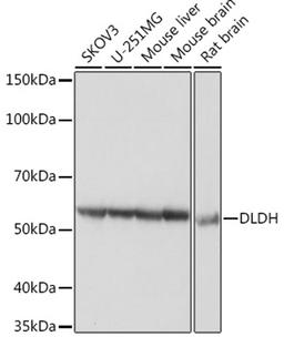 Western blot - DLDH Rabbit mAb (A5220)