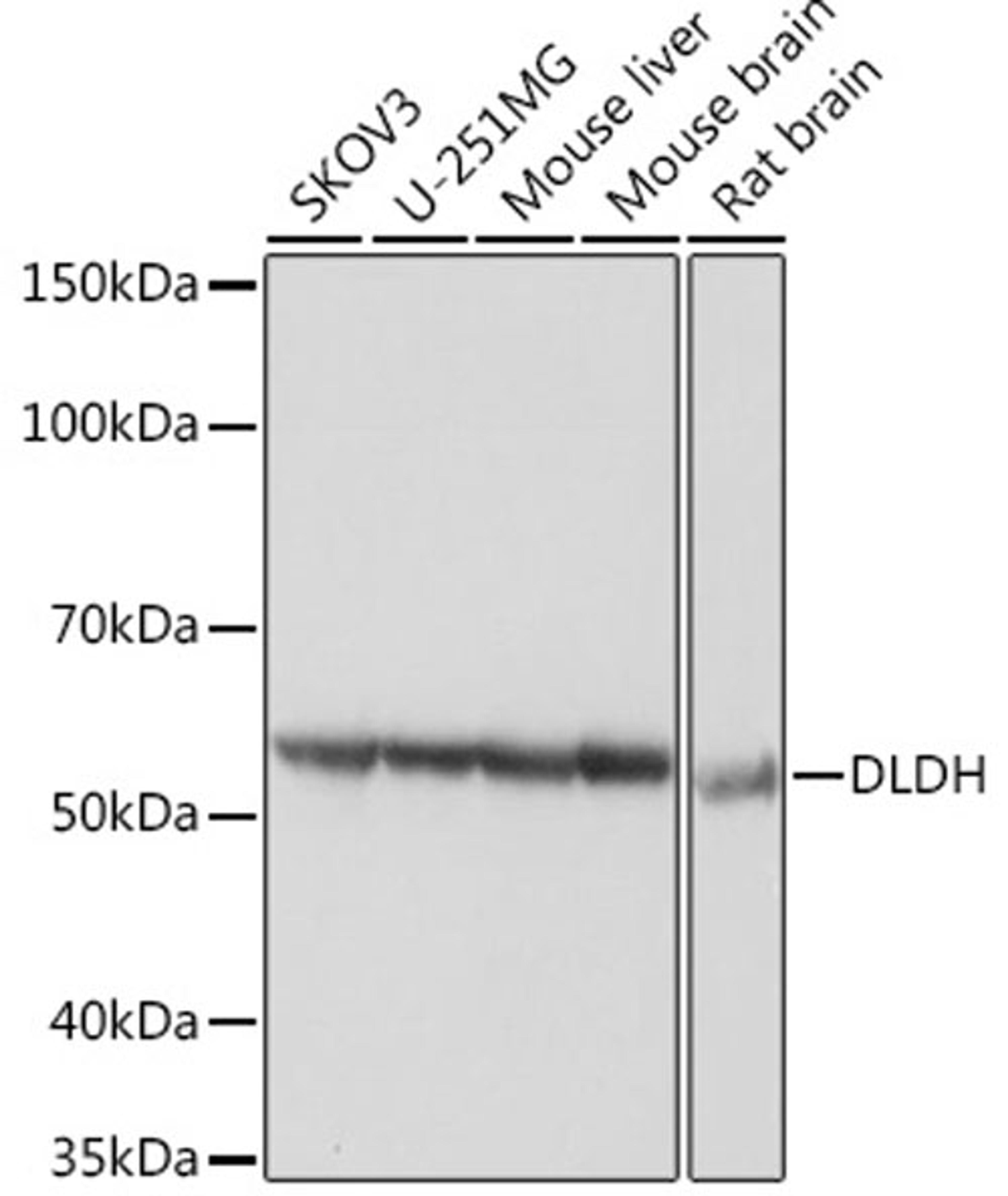 Western blot - DLDH Rabbit mAb (A5220)