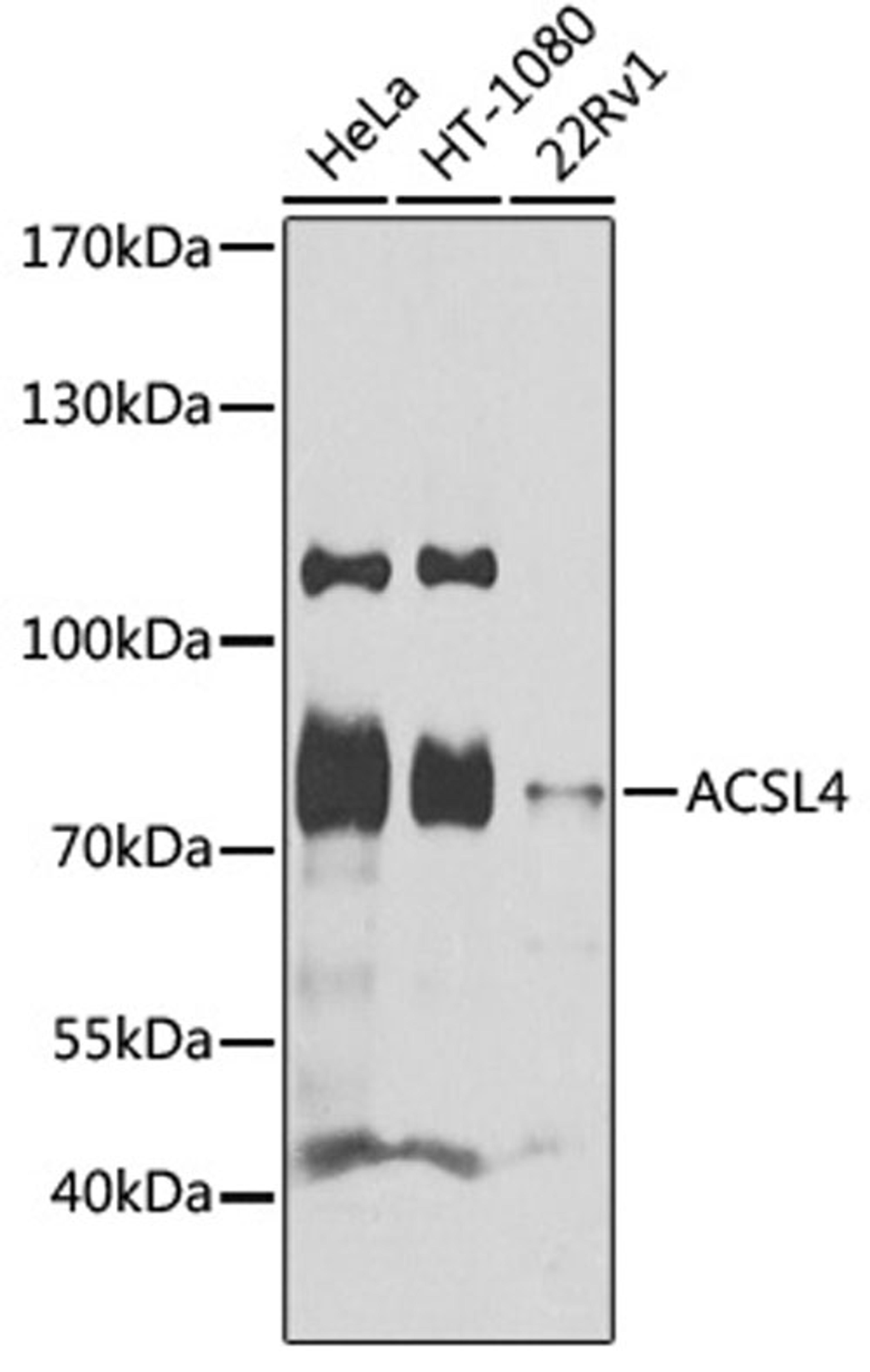 Western blot - ACSL4 antibody (A16848)