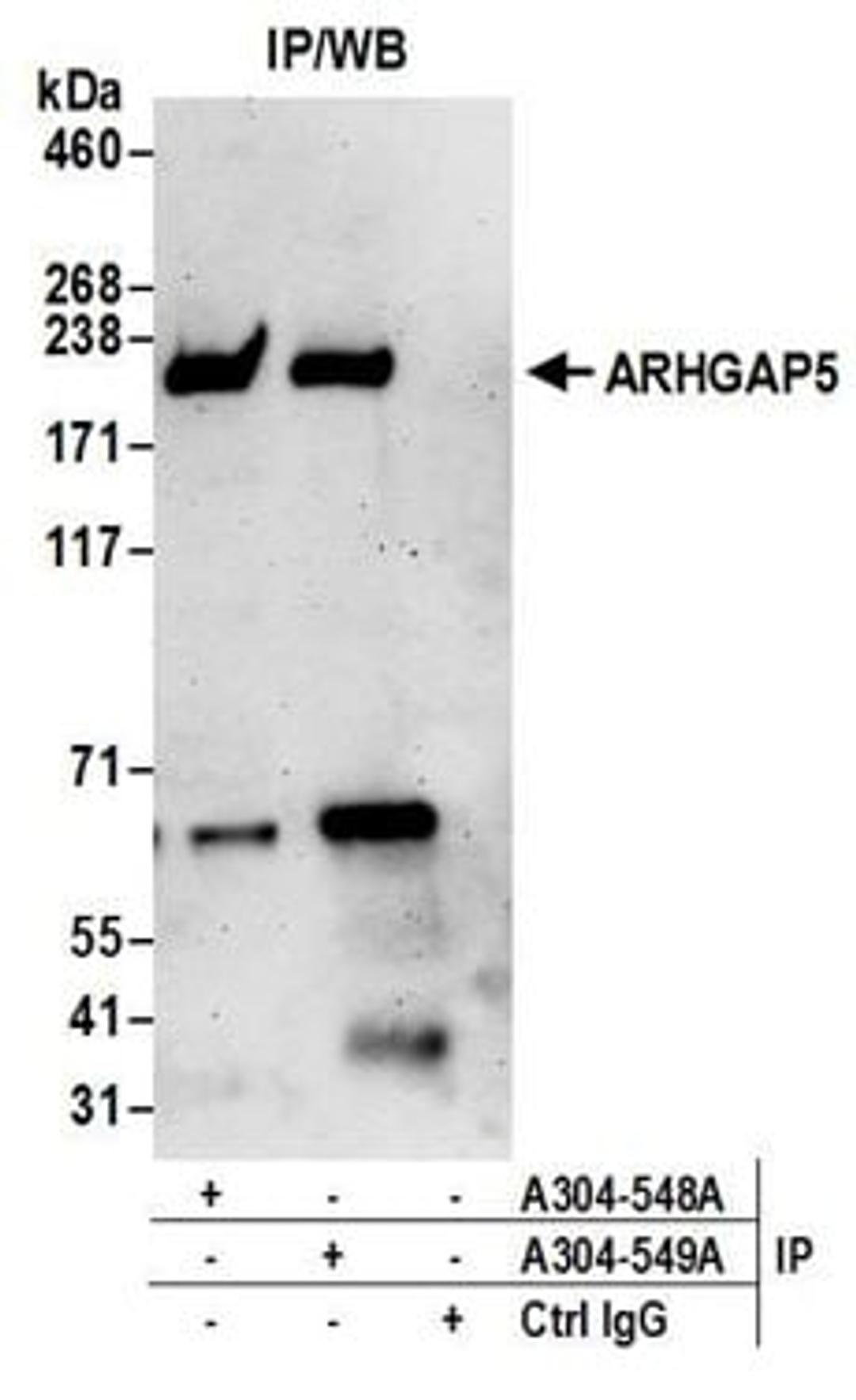 Detection of human ARHGAP5 by western blot of immunoprecipitates.