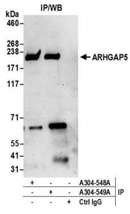 Detection of human ARHGAP5 by western blot of immunoprecipitates.