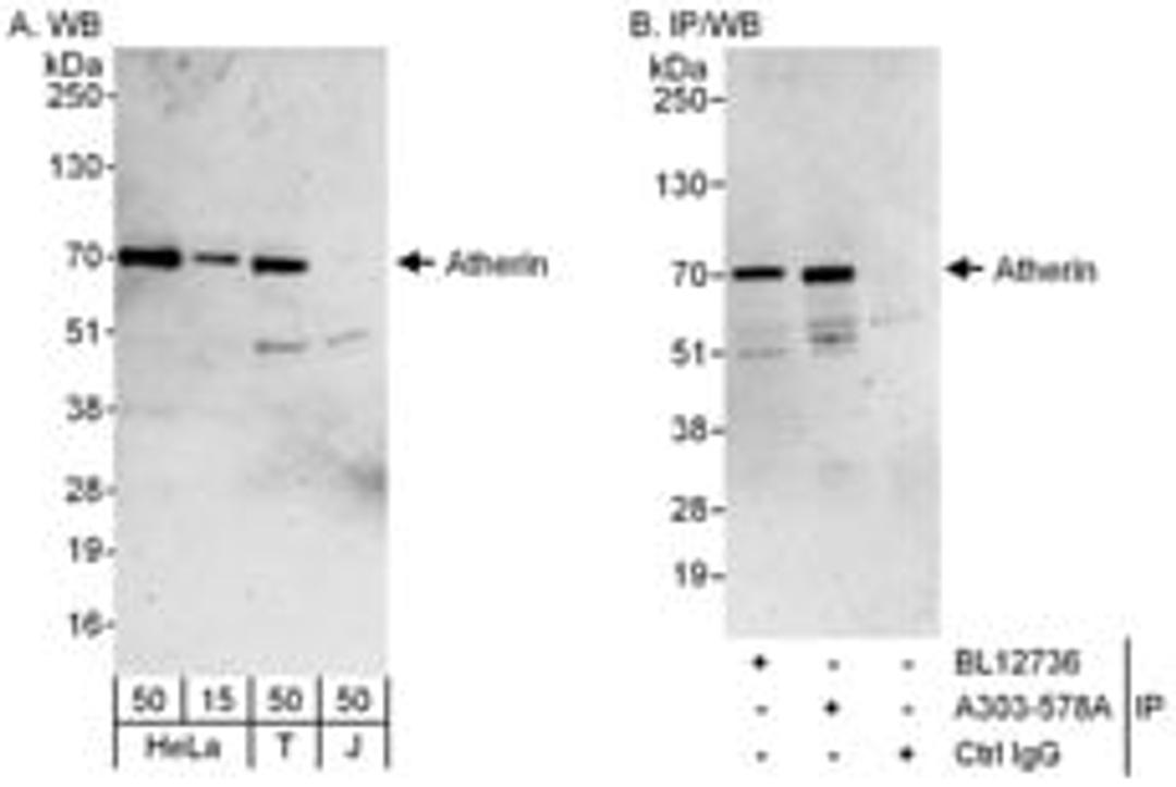 Detection of human Atherin by western blot and immunoprecipitation.