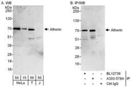 Detection of human Atherin by western blot and immunoprecipitation.