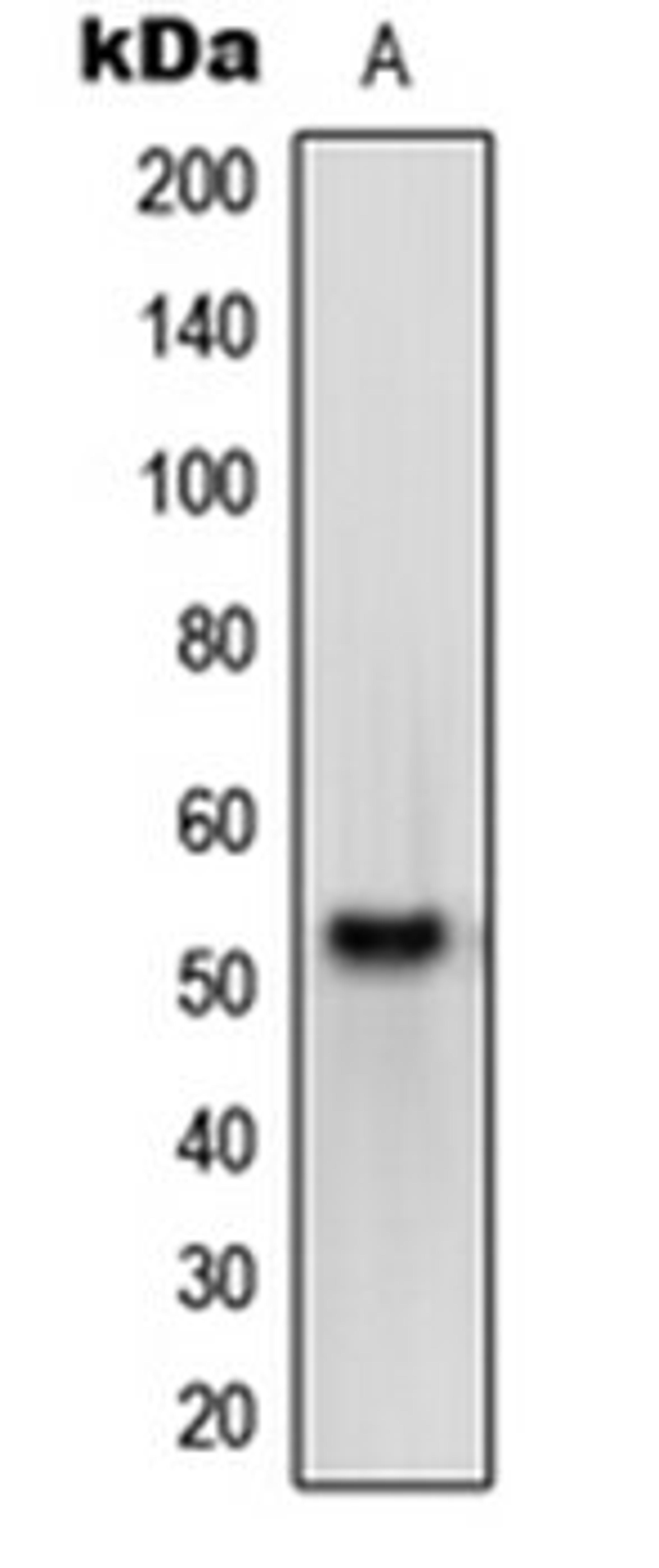 Western blot analysis of HEK293T (Lane 1) whole cell lysates using OPN4 antibody