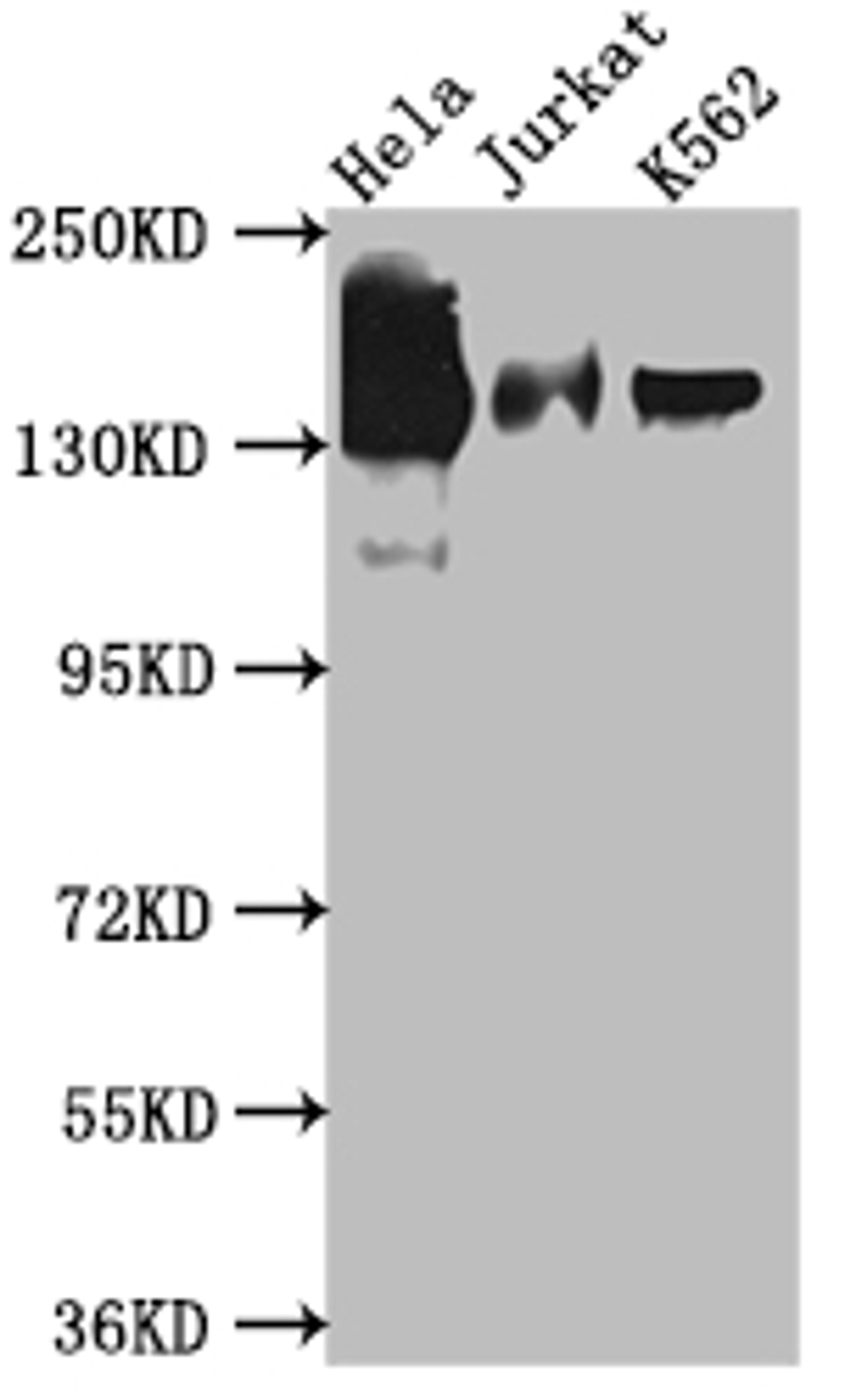 Western Blot. Positive WB detected in: Hela whole cell lysate, Jurkat whole cell lysate, K562 whole cell lysate. All lanes: SA2 antibody at 1:1000. Secondary. Goat polyclonal to rabbit IgG at 1/50000 dilution. Predicted band size: 142, 146 kDa. Observed band size: 142 kDa. 