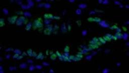 Detection of human PCNA by immunohistochemistry.