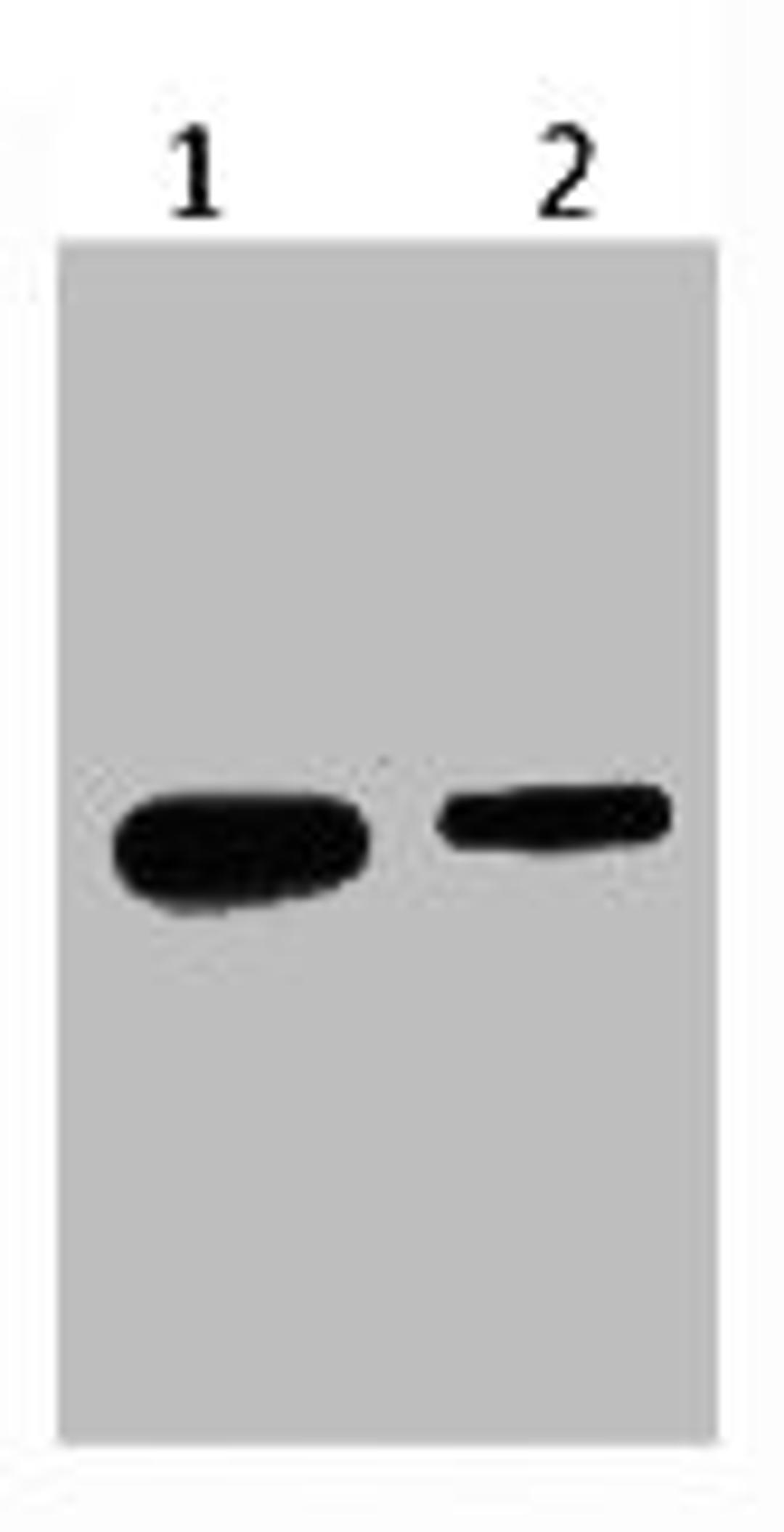 Western blot analysis of Recombinant protein, (Q72) diluted at 1) 1:5000 2) 1:10000