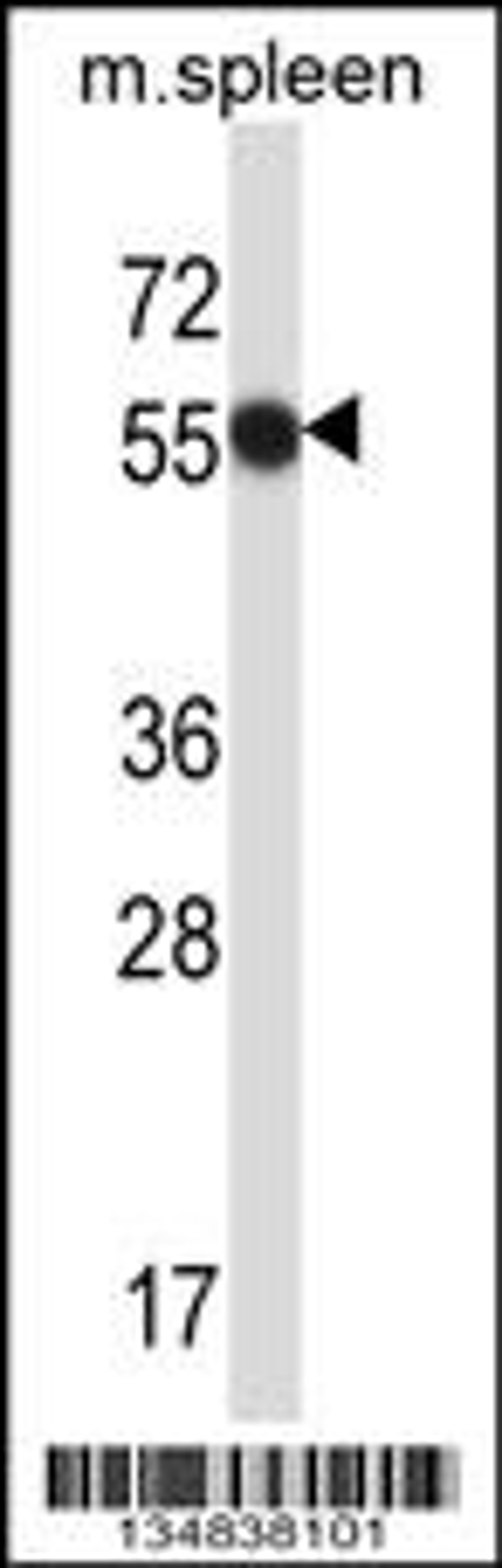 Western blot analysis in mouse spleen tissue lysates (35ug/lane).