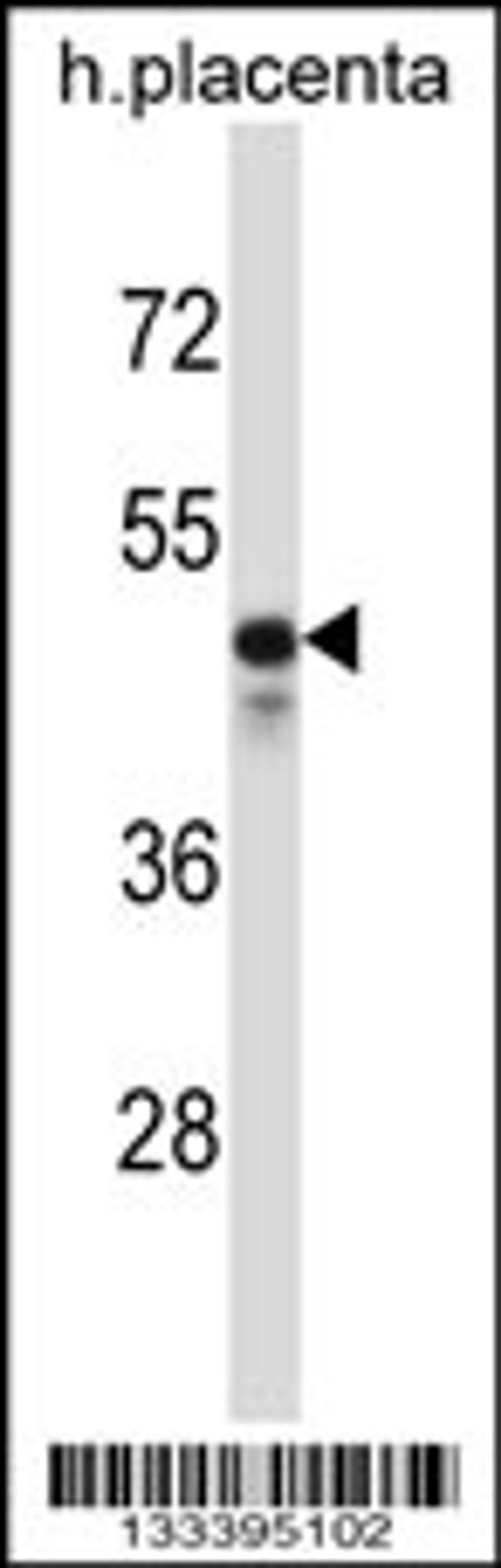 Western blot analysis in human placenta tissue lysates (35ug/lane).