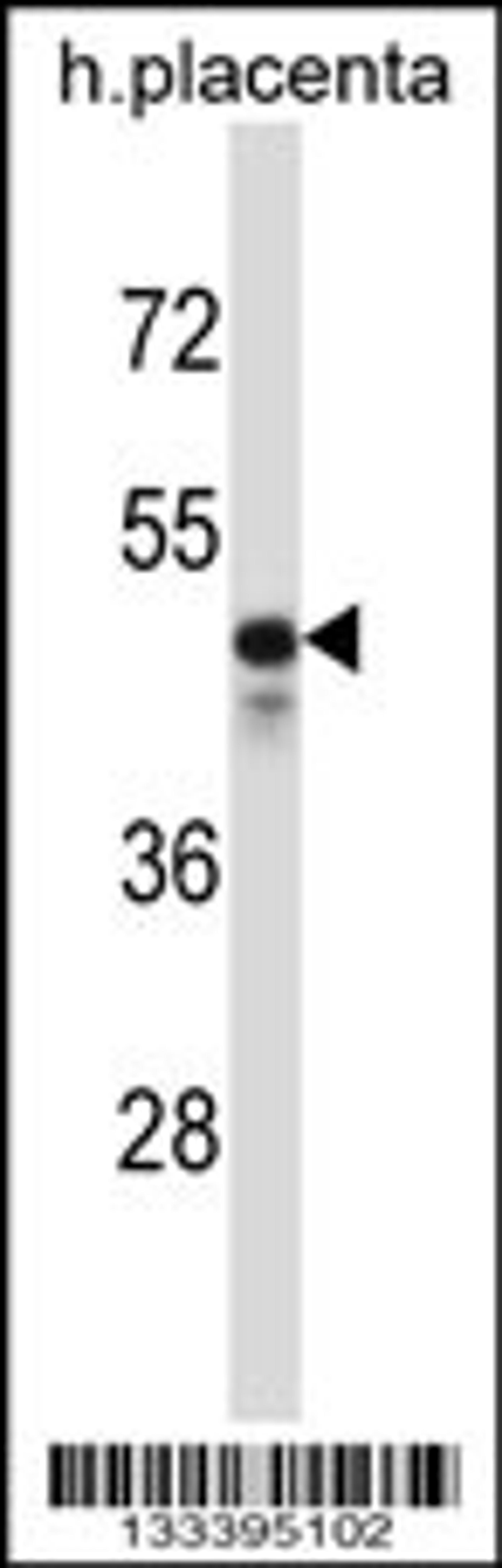 Western blot analysis in human placenta tissue lysates (35ug/lane).