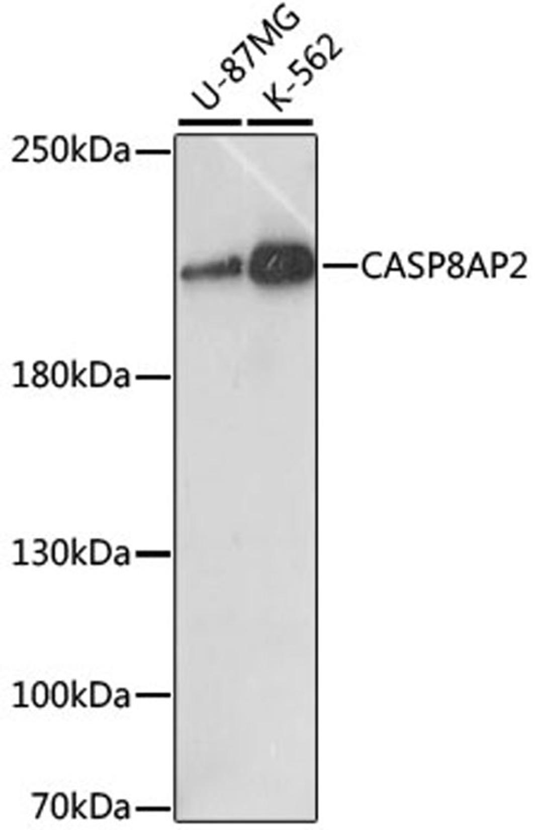 Western blot - CASP8AP2 antibody (A15770)